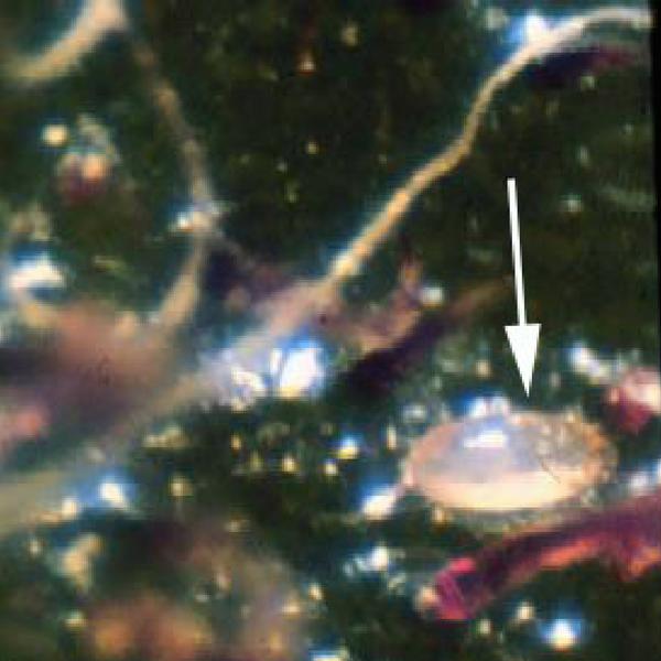 Figure 4. Extreme closeup of a cyclamen mite female.
