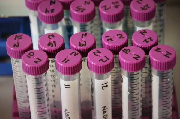 Pink capped vials in a genomics research lab