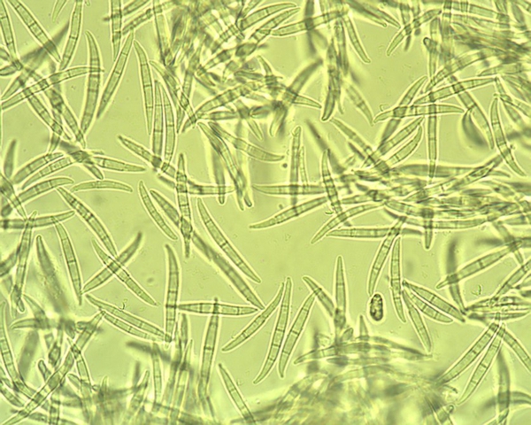 fusarium spores