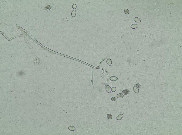 Sporangia of Phytophthora infestans under compound microscope