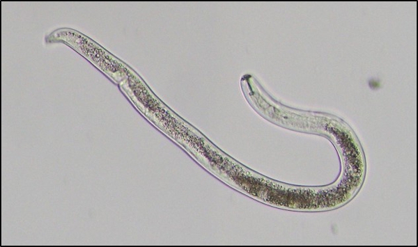 Photograph of a nematode (under microscope; ×100) indicating the three