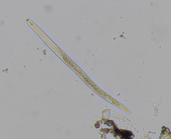 Image of a single lesion nematode as viewed under the microscope.