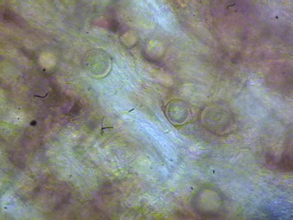 Phytophthora crown rot crown oospores