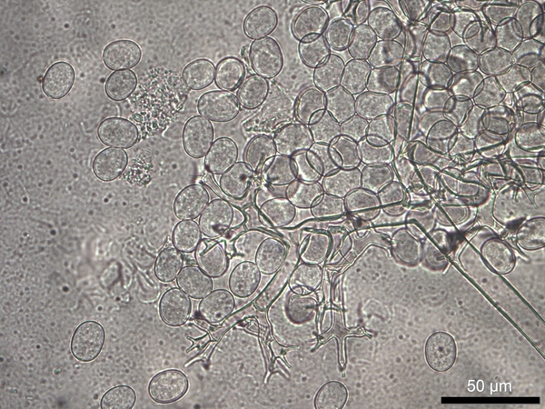 Sporangia and sporangiophore (structure that bears sporangia) of the downy mildew pathogen that affects tickseed (Plasmopara halsteadii).