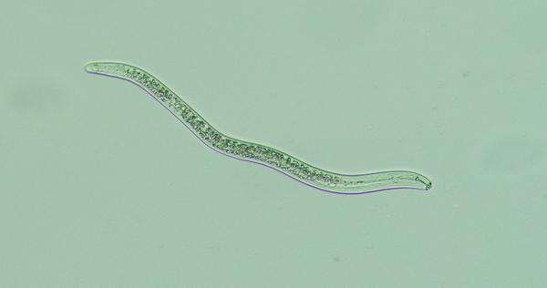 Worm-like lesion nematode as seen under the microscope