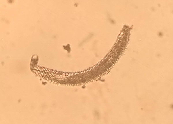 Image of a single ring nematode as viewed under the microscope.  Ring-like bands along the length of nematode body are characteristic of this nematode