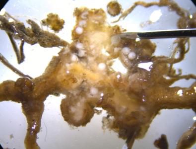 Adult female root-knot nematodes and egg sacks inside a root
