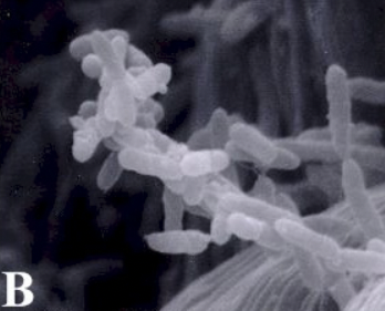 microscope photo of bacteria