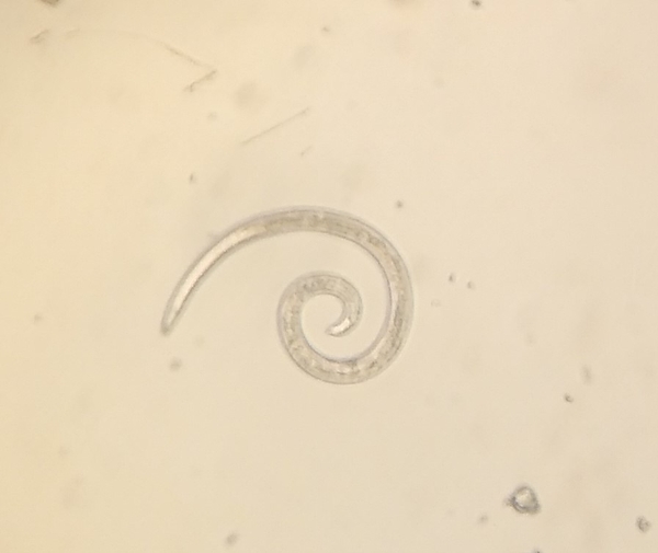 Image of a single spiral nematode as viewed under the microscope.