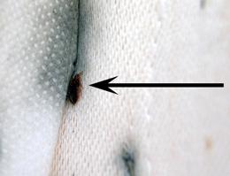 Figure 2. Bedbug and fecal smears on mattress.