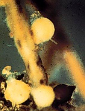 Microscope view of white females of soybean cyst nematode.